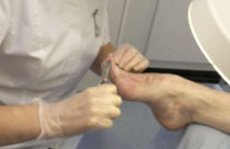 Foot care